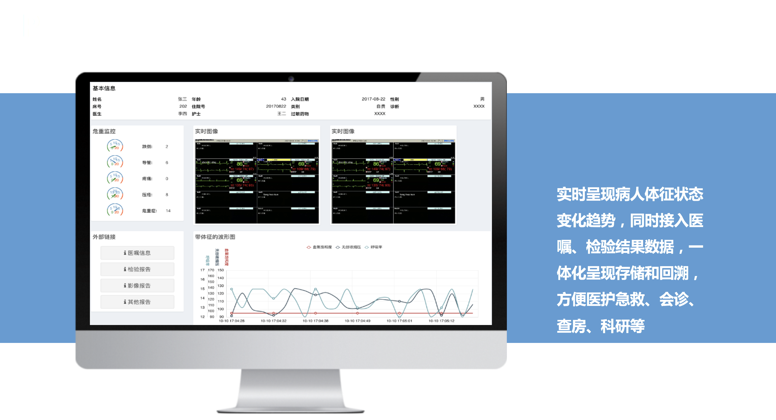 UniVue中央監(jiān)護(hù)系統(tǒng)